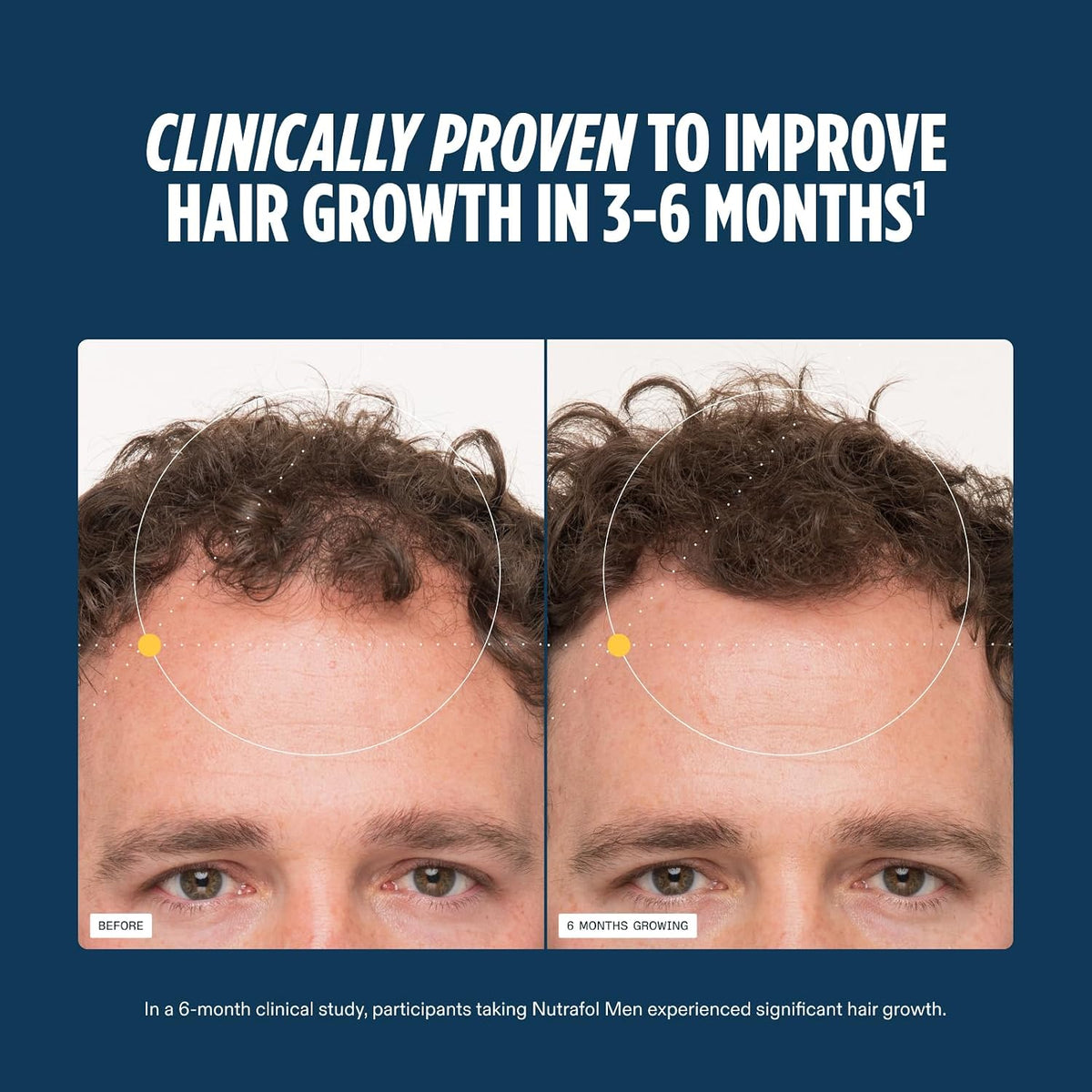 Nutrafol Men's Hair Supplement 120 Capsules, Pack of 3